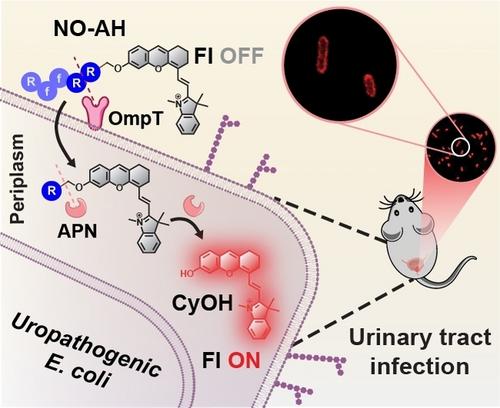 Enzymes in Synergy: Bacteria Specific Molecular Probe for Locoregional Imaging of Urinary Tract Infection in vivo