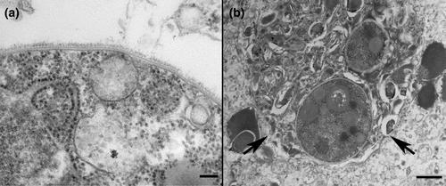 First report of the emerging rosette agent (Sphaerothecum destruens) in a captive held native north American cyprinid, the warpaint shiner (Luxilus coccogenis, Cope)