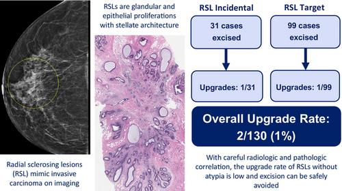 Radial sclerosing lesions found on core needle biopsy: excision can be safely avoided