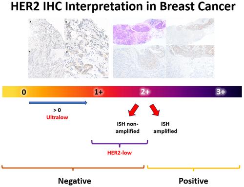 Human epidermal growth factor receptor 2 (HER2) status in breast cancer: practice points and challenges