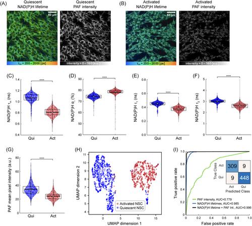 Autofluorescence lifetime flow cytometry with time-correlated single photon counting