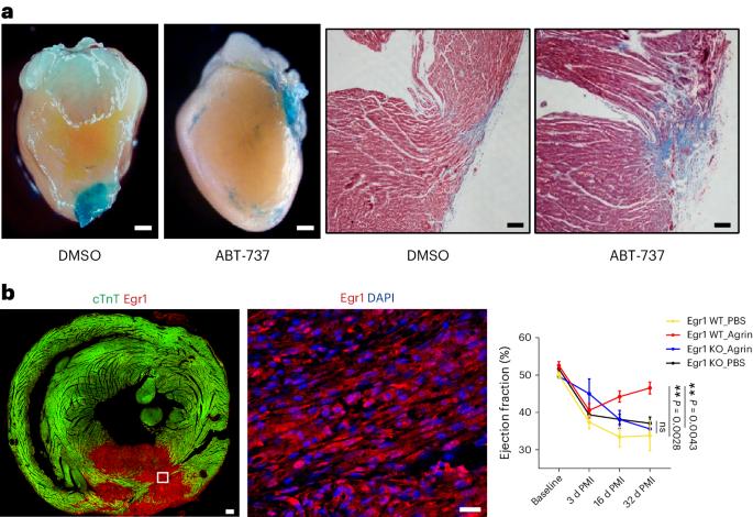 Cellular senescence is required for cardiac regeneration