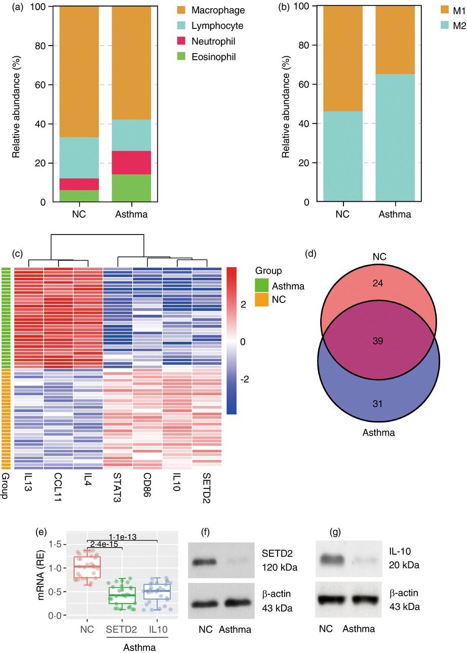 Regulation of SETD2 maintains immune regulatory function in macrophages to suppress airway allergy