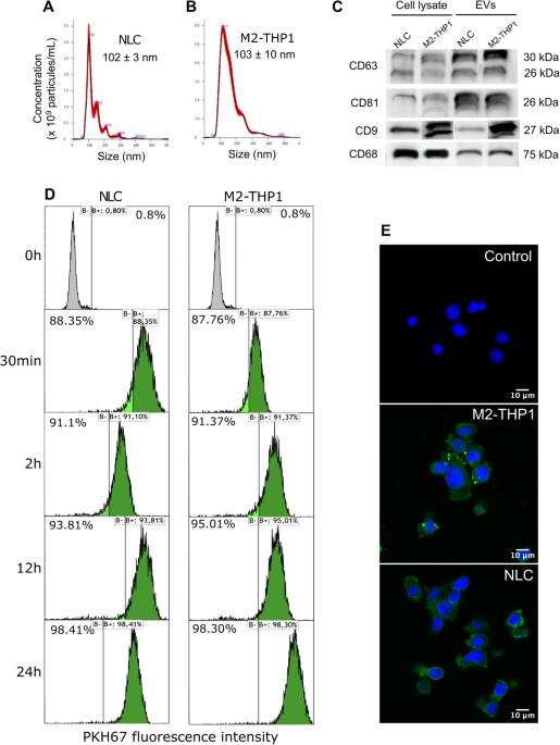 Extracellular vesicles from type-2 macrophages increase the survival of chronic lymphocytic leukemia cells ex vivo