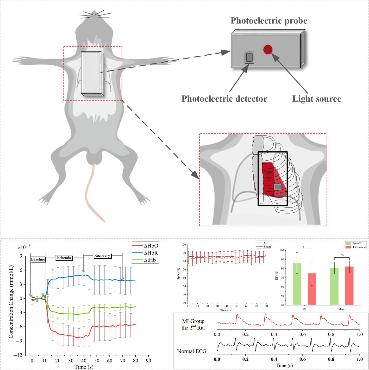 Noninvasive cardiac hemodynamics monitoring of acute myocardial ischemia in rats using near-infrared spectroscopy: A pilot study