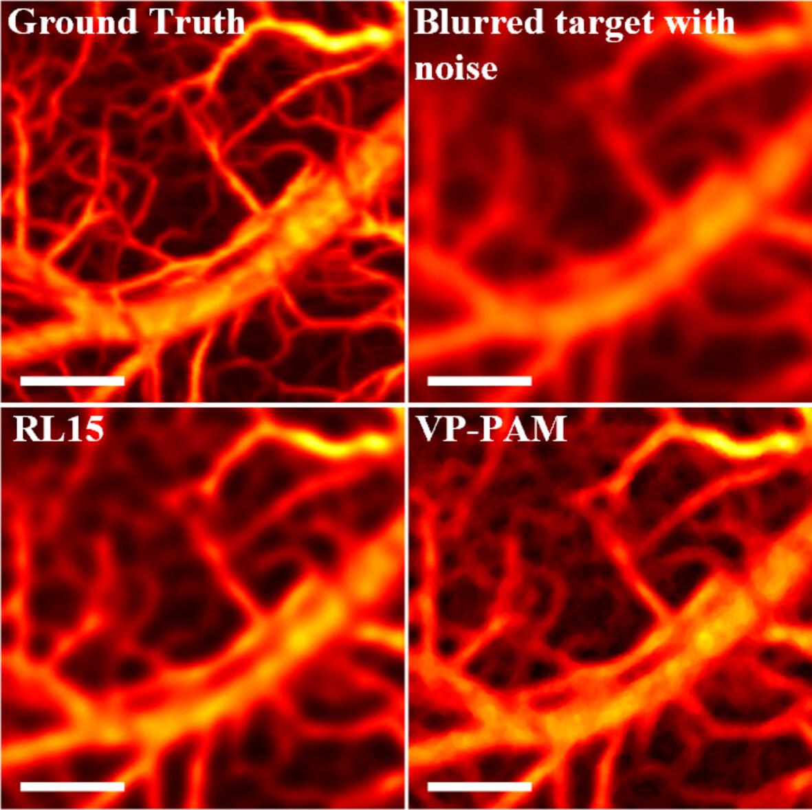 Virtual-point-based deconvolution for optical-resolution photoacoustic microscopy