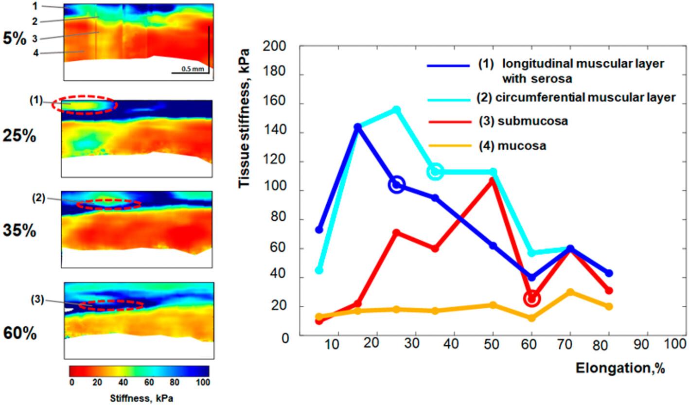 Detecting emergence of ruptures in individual layers of the stretched intestinal wall using optical coherence elastography: A pilot study