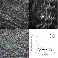 Extraction of collagen morphological features from second-harmonic generation microscopy images via GLCM and CT analyses: A cross-laboratory study