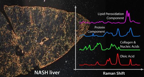 Correlative Quantitative Raman Chemical Imaging and MCR–ALS in Mouse NASH Model Reveals Direct Relationships between Diet and Resultant Liver Pathology