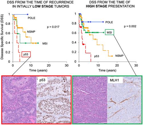 Molecular classification of metastatic and recurrent endometrial endometrioid carcinoma: prognostic relevance among low- and high-stage tumours