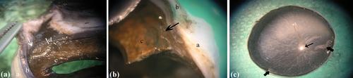 Comparative macroanatomical and scanning electron microscopy study of the eyeball in brachycephalic and mesocephalic dog breeds