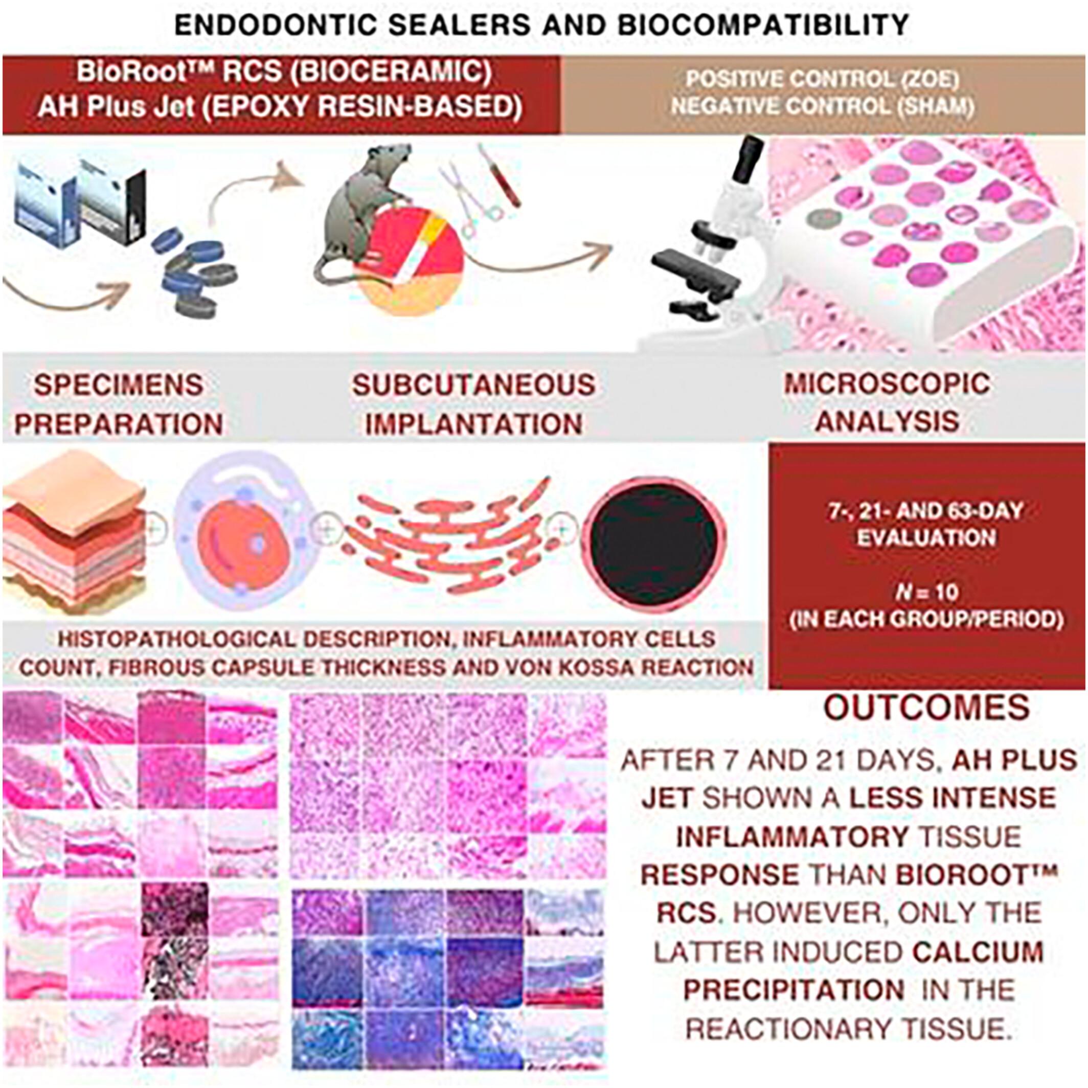 Inflammatory response to bioceramic and epoxy resin-based endodontic sealers implanted in mice subcutaneous tissue: An in vivo study