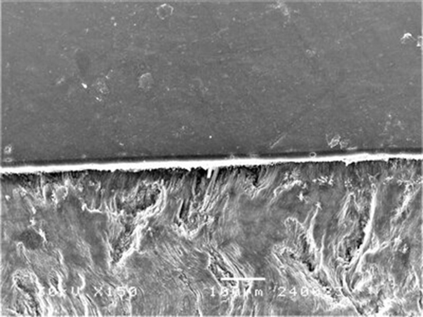 Bleaching effect on bonding performance of composite to enamel