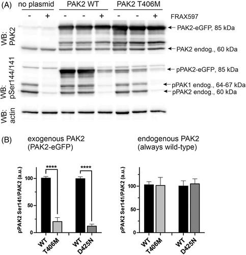 New kinase-deficient PAK2 variants associated with Knobloch syndrome type 2