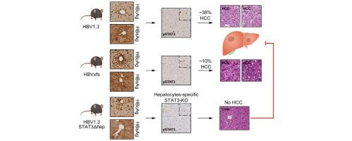 HBV-related HCC development in mice is STAT3 dependent and indicates an oncogenic effect of HBx