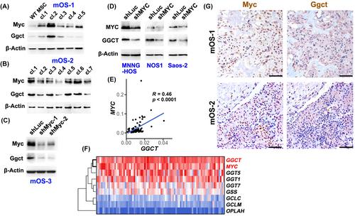 Myc upregulates Ggct, γ-glutamylcyclotransferase to promote development of p53-deficient osteosarcoma