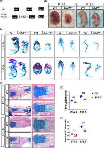 Protein phosphatase SCP4 regulates cartilage development and endochondral osteogenesis via FoxO3a dephosphorylation