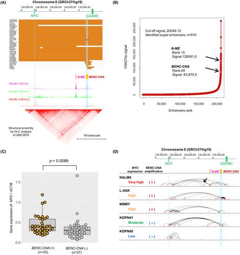 Acquired copy number amplification at the MYC enhancer in human B-precursor acute lymphoblastic leukemia cell lines