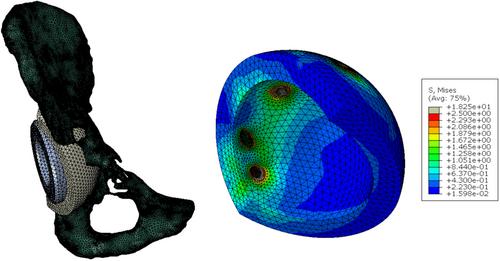 Computational modeling of revision total hip arthroplasty involving acetabular defects: A systematic review