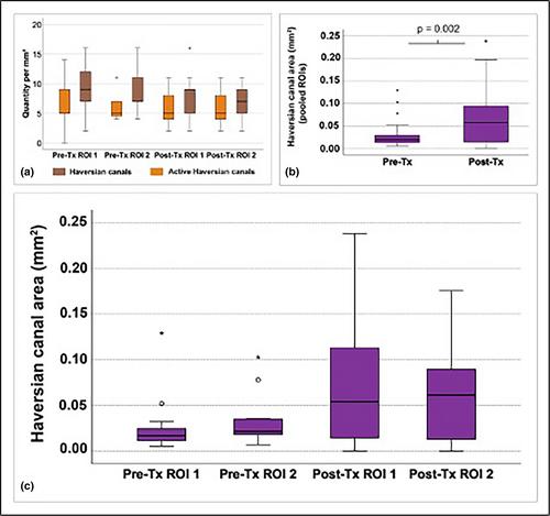 Vitality of autologous retromolar bone grafts for alveolar ridge augmentation after a 3-months healing period: A prospective histomorphometrical analysis