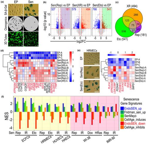 A new gene signature for endothelial senescence identifies self-RNA sensing by retinoic acid-inducible gene I as a molecular facilitator of vascular aging