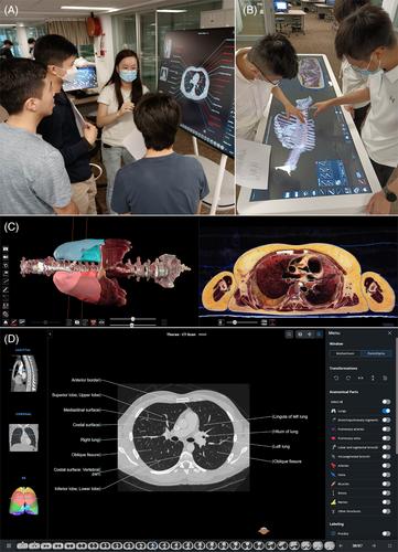 Facilitating active learning of sectional anatomy with technology-enhanced small-group tasks: Assessment of knowledge gains, technology usability, and students' perceptions