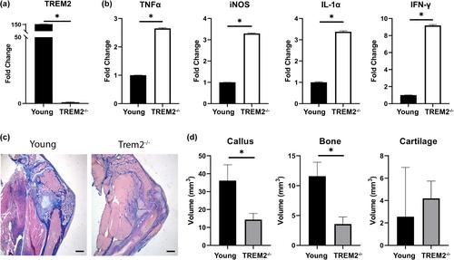 Age-related changes to macrophage subpopulations and TREM2 dysregulation characterize attenuated fracture healing in old mice