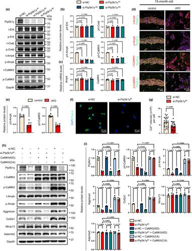 Pip5k1γ promotes anabolism of nucleus pulposus cells and intervertebral disc homeostasis by activating CaMKII-Ampk pathway in aged mice