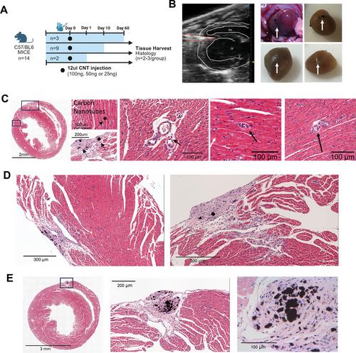 Development of a Mouse Cardiac Sarcoidosis Model Using Carbon Nanotubes