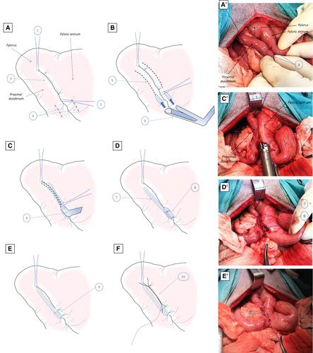 Finney and Jaboulay pyloroplasties for the treatment of benign gastric outlet lesions in dogs and cats: technique and outcome in 13 cases (2015-2024)