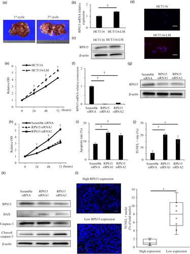 Clinical significance of ribosomal protein S15 expression in patients with colorectal cancer liver metastases