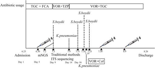 A case of central nervous system infection with Scedosporium boydii