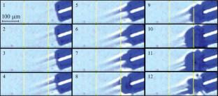 Prospects for Using a Pulsed Tm-Doped Fiber Laser for Lithotripsy of Salivary Stones