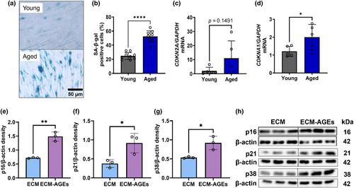 Lens capsule advanced glycation end products induce senescence in epithelial cells: Implications for secondary cataracts