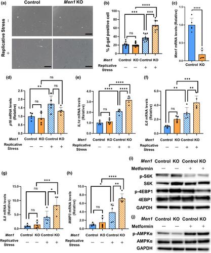 Cellular senescence by loss of Men1 in osteoblasts is critical for age-related osteoporosis