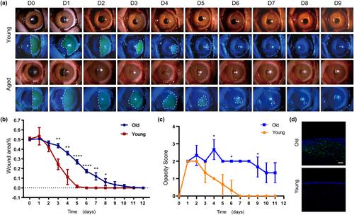 Deficiency of SECTM1 impairs corneal wound healing in aging