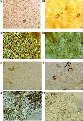 Anatomy and micromorphology of Tilia species from Turkey and its taxonomic implication