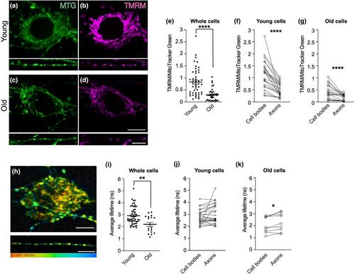 Age-specific and compartment-dependent changes in mitochondrial homeostasis and cytoplasmic viscosity in mouse peripheral neurons