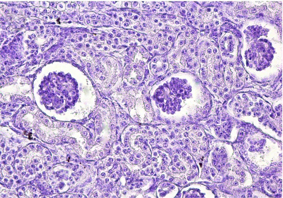 Fetal development of the urinary tract of Cuniculus paca