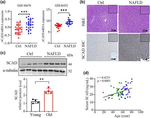 Aging-induced short-chain acyl-CoA dehydrogenase promotes age-related hepatic steatosis by suppressing lipophagy