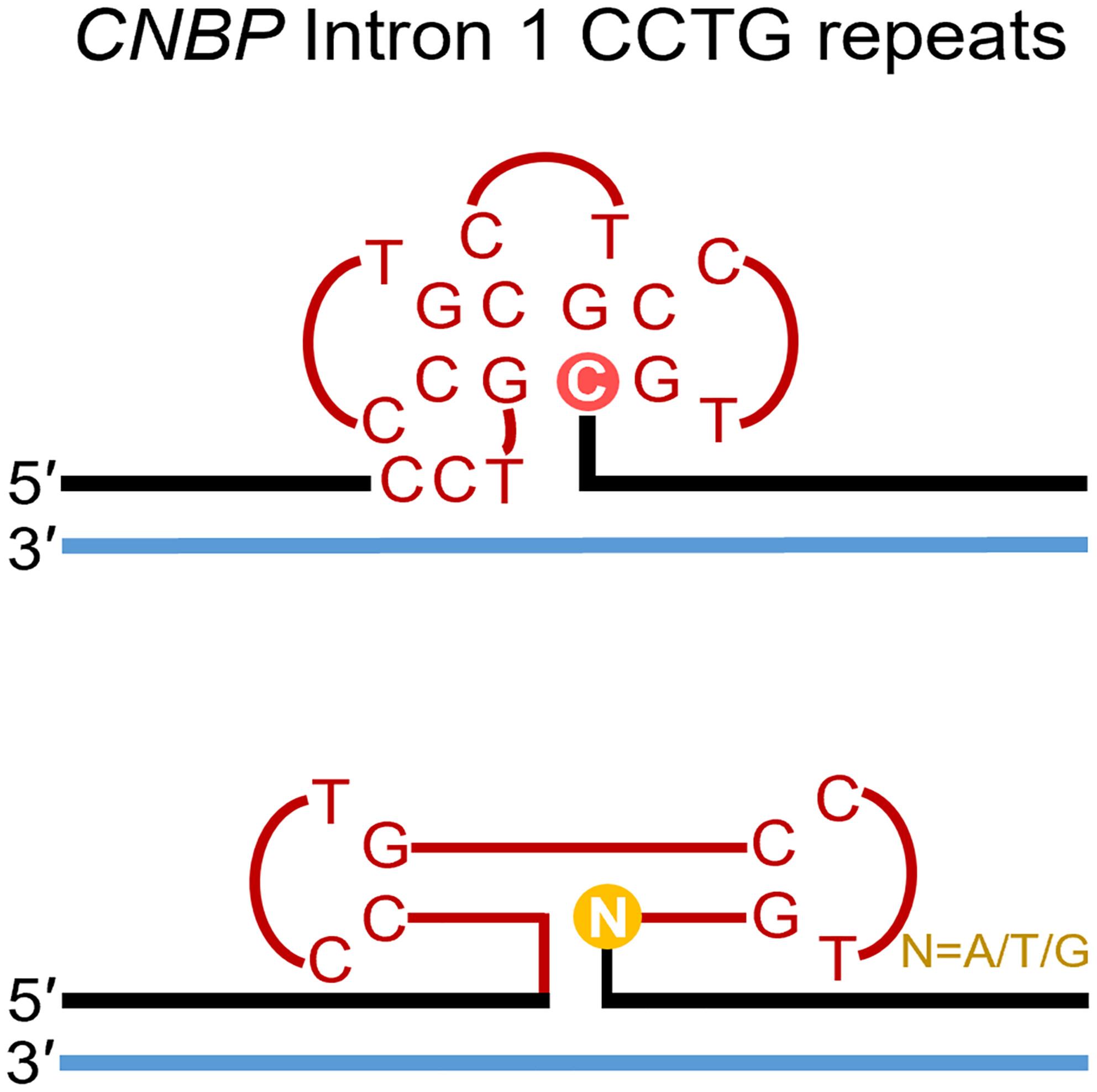 Effects of interrupting residues on DNA dumbbell structures formed by CCTG tetranucleotide repeats associated with myotonic dystrophy type 2