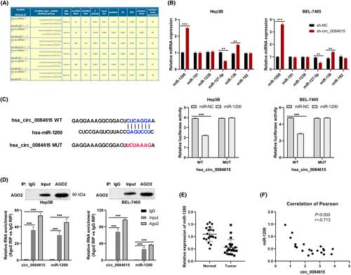 Circ_0084615 promotes epithelial-mesenchymal transition-mediated tumor progression in hepatocellular carcinoma