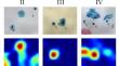 Background removal for debiasing computer-aided cytological diagnosis.