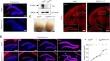 Dentate Gyrus Morphogenesis is Regulated by an Autism Risk Gene Trio Function in Granule Cells.