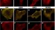 Glyoxal-methyl-ethylene sulfonic acid fixative enhances the fixation of cytoskeletal structures for Förster resonance energy transfer measurements.