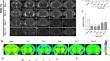 Single-Cell Transcriptomics Revealed White Matter Repair Following Subarachnoid Hemorrhage.