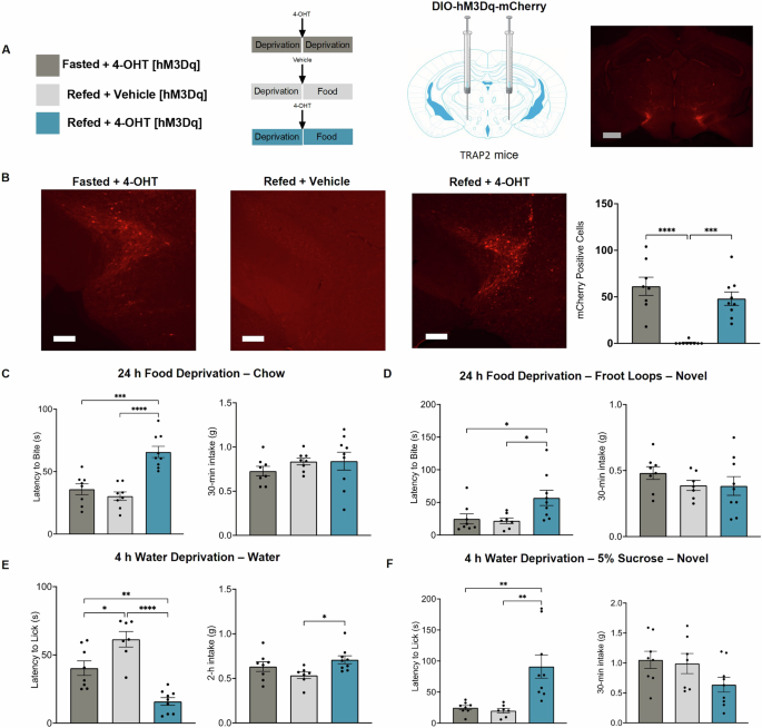 The parasubthalamic nucleus refeeding ensemble delays feeding initiation and hastens water drinking