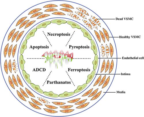 Regulated vascular smooth muscle cell death in vascular diseases