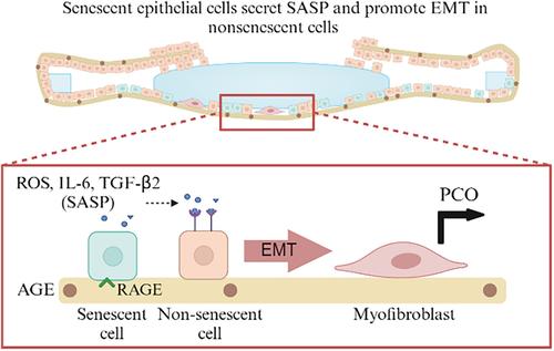 Lens capsule advanced glycation end products induce senescence in epithelial cells: Implications for secondary cataracts