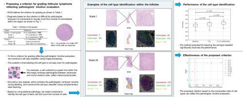 A study of criteria for grading follicular lymphoma using a cell type classifier from pathology images based on complementary-label learning